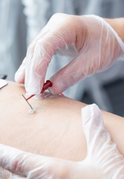 Centro Phyos - foto especialidad EPTE neuromodulación